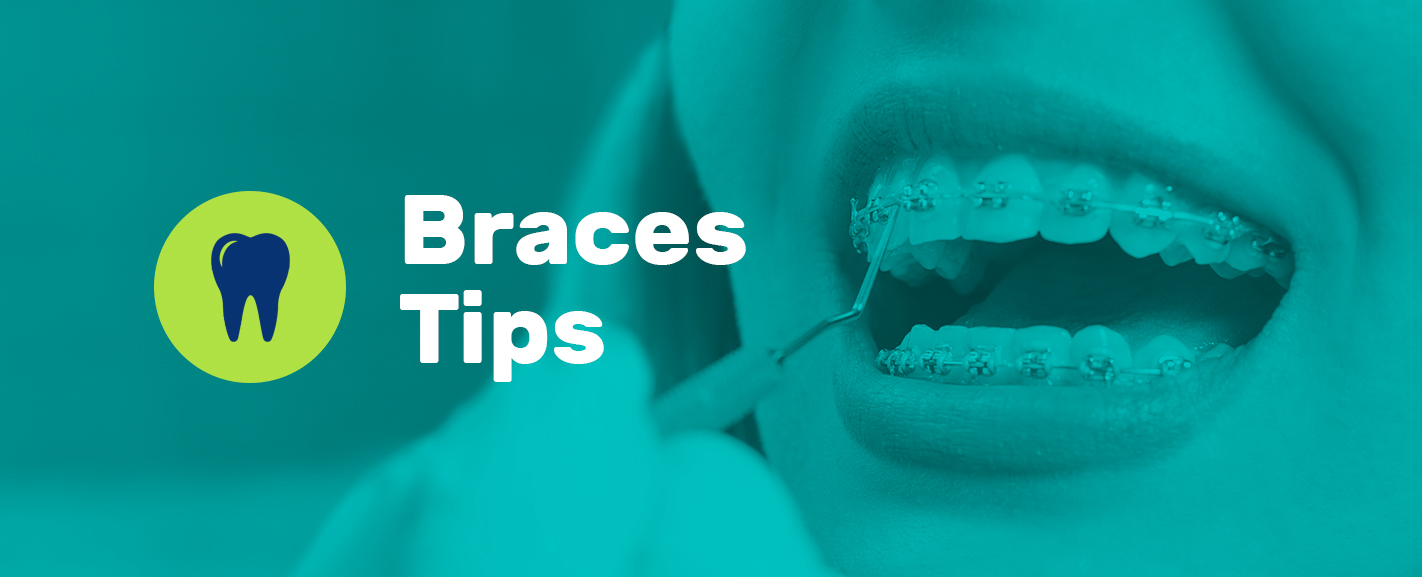 How To Take Care Of Braces Braces Care Routine And Tips